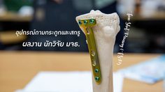 กระบวนการ Fine Shot Peening