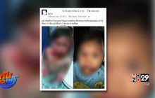 พ่อร้องลูกถูกหมากัดเย็บ 12เข็ม เจ้าของปัดความรับผิดชอบ