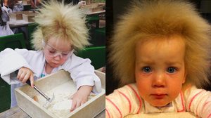 หนูน้อย วัย 7 ขวบ ป่วยประหลาด ผมชี้ฟูเหมือนไอน์สไตน์ แต่นี่แหละคือสิ่งพิเศษ!