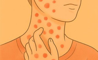 ซิฟิลิส–หนองใน พุ่งสูง! แพทย์เตือนวัยรุ่นไทยเสี่ยงหนัก หากไม่ป้องกัน