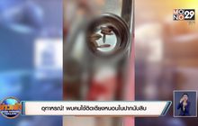 อุทาหรณ์ ! พบคนไข้ติดเตียงหนอนในปากนับสิบ