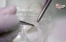 นักวิทย์สิงคโปร์พัฒนาผิวหนังเทียม