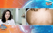 รู้ทัน!อันตรายจากแสงแดด