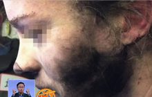 ออสเตรเลียหาสาเหตุหูฟังระเบิดบนเครื่องบิน