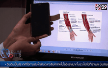 ความเจ็บป่วยจากอุปกรณ์อิเล็กทรอนิกส์