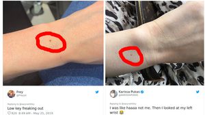 มีคนบอกว่า ผู้หญิงทุกคนมีขี้แมลงวันที่ข้อมือ เช็คซิ๊แขนเธอล่ะ..มีมั้ย?