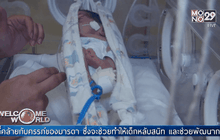 บราซิลใช้เปลรักษาทารกคลอดก่อนกำหนด