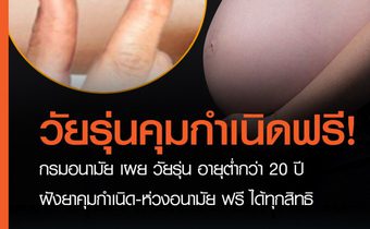 กรมอนามัย เผย วัยรุ่น อายุต่ำกว่า 20 ปี ฝังยาคุมกำเนิด-ห่วงอนามัย ฟรี ได้ทุกสิทธิ