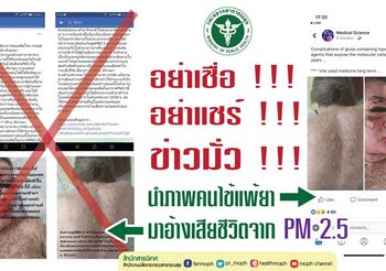 สธ. เตือนอย่าหลงเชื่อข่าวมั่ว คนตายเพราะฝุ่น PM2.5 ยืนยันยังไม่มีใครเสียชีวิต