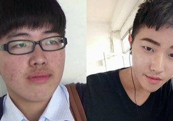 หนุ่มจีนเรียนเสริมหล่อจากยูทูป เปลี่ยนจากหนุ่มเห่ยเป็นหนุ่มหล่อ