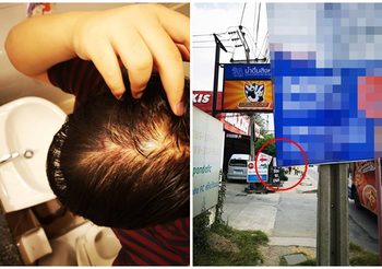 ไม่โกรธ แต่เจ็บมาก! หนุ่มเดินไม่ทันระวัง ‘ป้ายหาเสียง’ เฉาะศีรษะเป็นรูเลือดออก