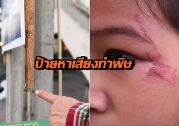 ป้ายหาเสียงทำพิษ ! เด็กป. 3 เดินชนป้าย บริเวณซอยลาดพร้าว 101