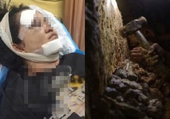 สาว 24 ถูกพ่อใช้ค้อนทุบหน้าเละ เหตุเรียนจบแต่ยังตกงาน