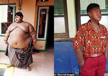 Arya Permana เด็กที่อ้วนที่สุดในโลก ตอนนี้เปลี่ยนแปลงตัวเอง กลับมาผอมแล้ว