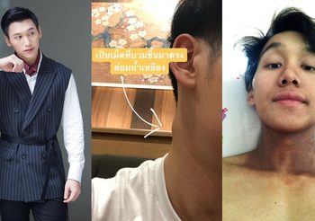 ประสบการณ์ของหนุ่มรักสุขภาพ ไม่ดื่มเหล้า ไม่สูบบุหรี่ แต่ป่วยเป็นมะเร็งและต่อสู้จนเอาชนะโรคร้ายได้