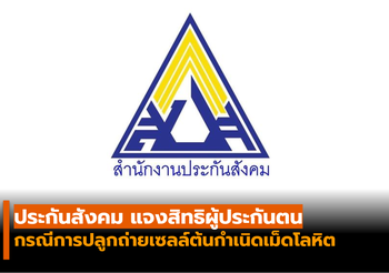 ประกันสังคม แจงสิทธิผู้ประกันตน กรณีการปลูกถ่ายเซลล์ต้นกำเนิดเม็ดโลหิต