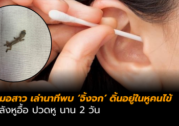 หมอสาว โพสต์เล่า คนไข้หูอื้อ ปวดหู นาน 2 วัน พบจิ้งจกดิ้นอยู่ในรูหู