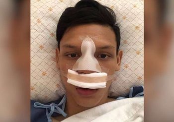 หัวใจหล่อ! ศุภชัย ฝืนอาการจมูกหักช่วย บุรีรัมย์ ดวล เชียงใหม่