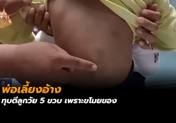 พ่อเลี้ยงอ้างทุบตีลูกวัย 5 ขวบ เพราะขโมยของ