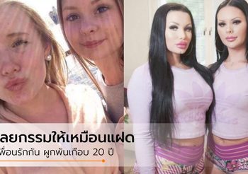 เพื่อนรักที่แท้ทรู! สองเพื่อนซี้ ตัดสินใจทำ ศัลยกรรม ให้เหมือนกันราวกับ ฝาแฝด