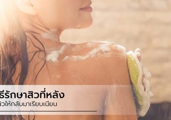 บอกต่อ วิธีรักษาสิวที่หลัง ฟื้นฟูผิวให้กลับมาเนียนสวย ใส่เสื้อผ้ากี่ทีก็มั่นใจ
