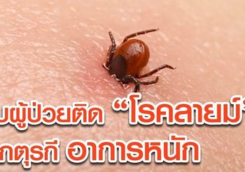 พบผู้ป่วยติด “โรคลายม์”