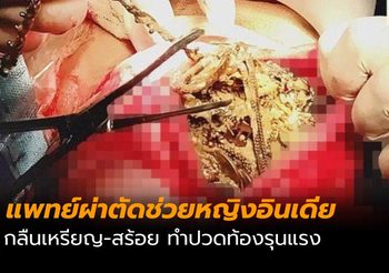 หญิงอินเดียปวดท้องหนัก ก่อนพบกลืนเหรียญ – สร้อยลงท้อง