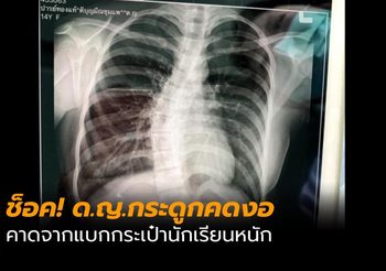 แม่ช็อค! ลูกสาวกระดูกคดงอ  คาดจากแบกกระเป๋านักเรียน