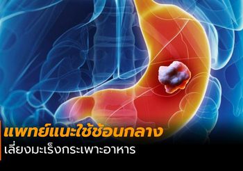 หมอเผยวิธีป้องกัน มะเร็งกระเพาะอาหาร ทำได้ง่ายด้วยการใช้ช้อนกลาง