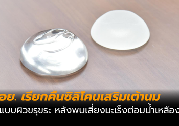 เรียกคืนเต้านมเทียมซิลิโคนนาเทรล หลังพบเสี่ยงมะเร็งต่อมน้ำเหลือง