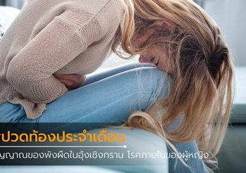 ปวดท้องประจำเดือน ผิดปกติ สัญญาณของ พังผืดในอุ้งเชิงกราน