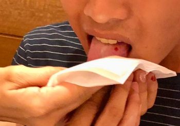 พ่อโวยร้านอาหารดัง เศษแก้วในอาหารบาดลิ้นลูกชายเลือดอาบ