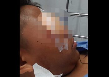 ตำรวจ ชี้แจงเหตุ อาสาฯ ปาเศษหินใส่กลุ่มวัยรุ่น จนบาดเจ็บ