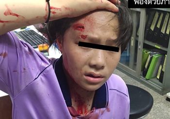 ด.ญ.เลือดอาบทั่วหน้า อ้างถูกตร.ฟาด หลังหนีด่านตรวจ