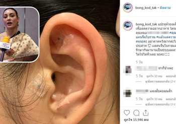 “ตั๊ก บงกช” เคลียร์ดราม่า ติดเมล็ดผักกาดช่วยลดความอยากอาหาร