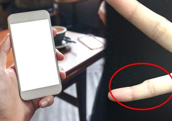 Smartphone Pinky นิ้วก้อยงอ จากการใช้โทรศัพท์มือถือนานเกินไป!!