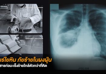 แร่ใยหิน สารก่อมะเร็งร้าย ภัยใกล้ตัวกว่าที่คิด