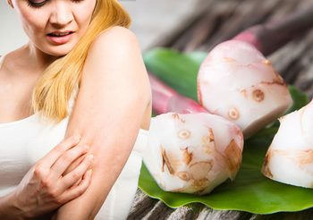6 วิธีแก้ผื่นคันง่ายๆ รักษาโรคผิวหนัง ด้วยวิธีแบบธรรมชาติ!!