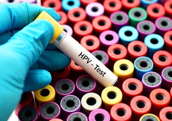 HPV ตัวการร้าย มะเร็งปากมดลูก – เผยวิธีป้องกันที่ดีที่สุด