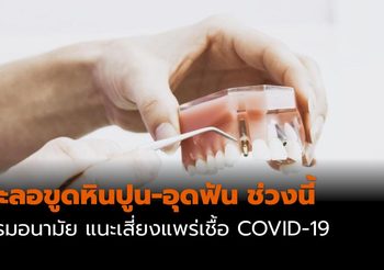 กรมอนามัย แนะชะลอขูดหินปูน-อุดฟัน ช่วงนี้ เสี่ยงแพร่เชื้อ COVID-19