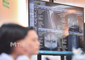 หมอแถลง อาการตูน บอดี้สแลม พบหมอนรองกระดูกคอทับเส้นประสาท 2 ข้อ