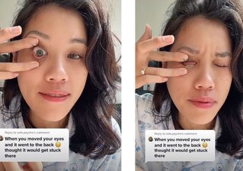 รู้แล้วชีวิตเปลี่ยน เคล็ดลับ ถอดคอนแทคเลนส์ ด้วยวิธีแสนง่าย ไม่ต้องใช้นิ้ว