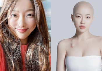 Dawn Lee ยูทูปเบอร์สาวผู้โด่งดัง เสียชีวิตด้วยโรคมะเร็ง ในวัย 30ปี