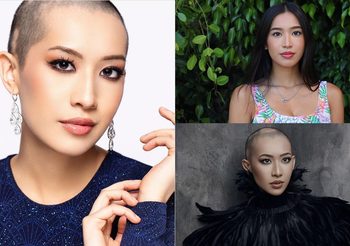 Renee Reyes นางงามหัวล้าน ที่คนทั่วโลกตกหลุมรักความสวย ในแบบที่เธอเป็น