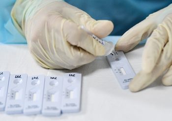 สปสช. ใช้ชุดตรวจโควิด ‘Rapid Antigen Test’ รู้ผลใน 30 นาที