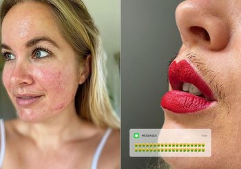 Joanna Kenny ผู้เรียกร้องให้สาวๆเลิกใช้แอปผิวเนียน โชว์หนวด รูขุมขน มันก็สวยแบบมนุษย์