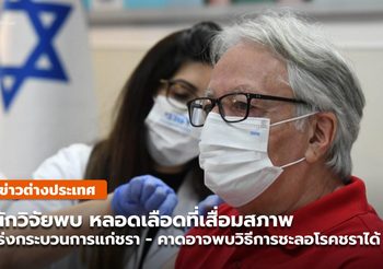 อิสราเอลวิจัยพบเหตุที่ทำให้เกิดการแก่ชรา ที่อาจจะชะลอ ‘โรคชรา’ ได้