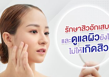 สิวอักเสบคืออะไร พร้อมวิธีรักษาสิวอักเสบ ง่าย ๆ ที่ใครก็สามารถทำได้