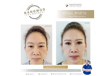 อดีตสู่ปัจจุบันกับความมุ่งมั่นให้ศัลยกรรมเป็นมากกว่าความงาม “นพ.สุรสิทธิ์ อัศดามงคล” ต้นตำรับศัลยกรรมไทย
