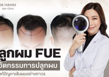 ปลูกผม FUE นวัตกรรมการปลูกผมเพื่อแก้ปัญหาเส้นผมอย่างถาวร